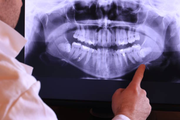 Best Emergency Dental Care for Broken or Chipped Teeth in Angola, NY